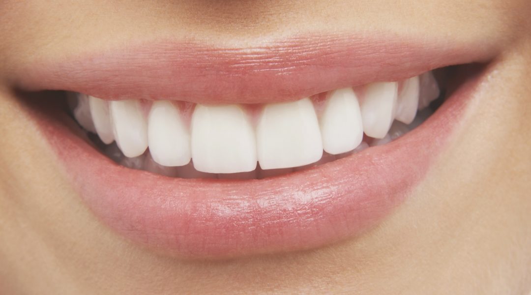 Too Shy About Your Gums? Try Gum Reduction in Aurora!